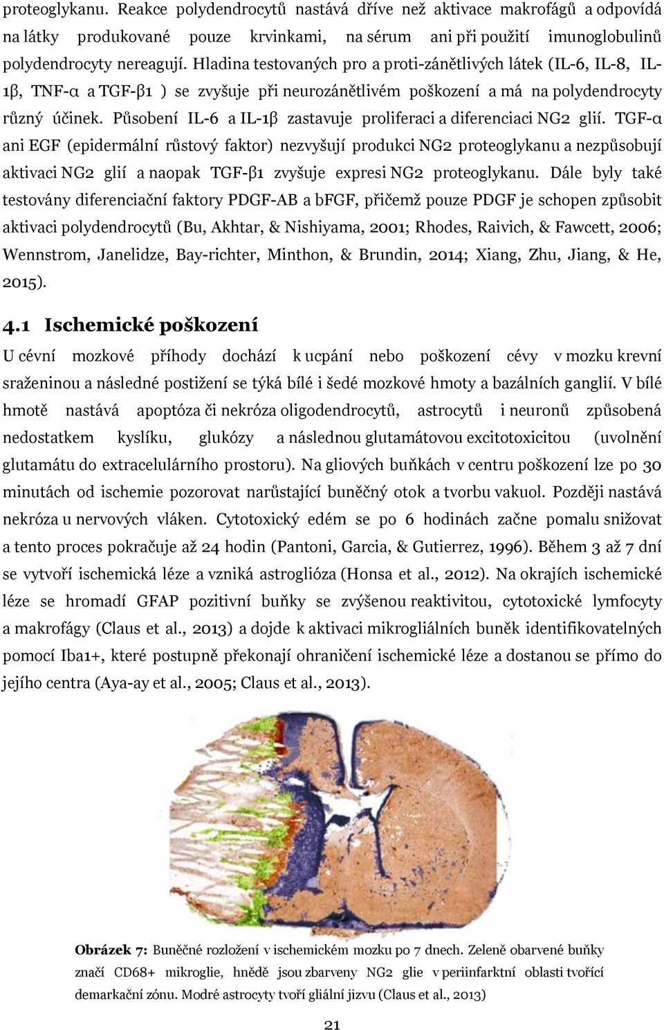 Působení IL-6 a IL-1β zastavuje proliferaci a diferenciaci NG2 glií.