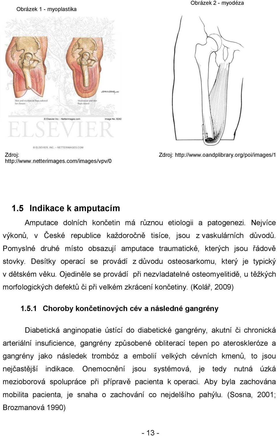 Pomyslné druhé místo obsazují amputace traumatické, kterých jsou řádově stovky. Desítky operací se provádí z dŧvodu osteosarkomu, který je typický v dětském věku.