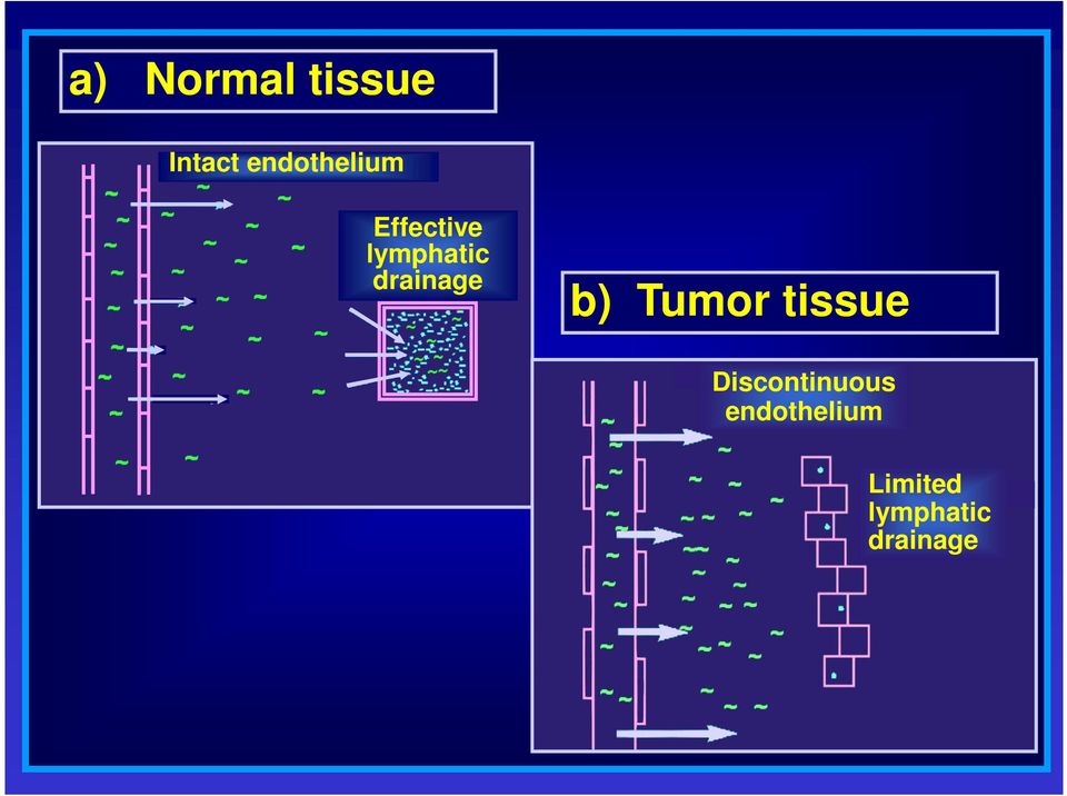 drainage b) Tumor tissue