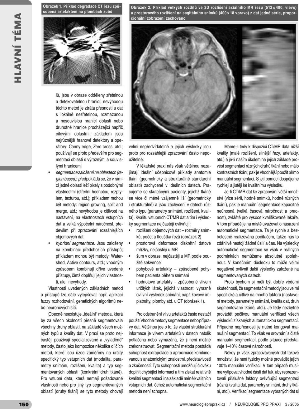 jsou v obraze odděleny zřetelnou a detekovatelnou hranicí; nevýhodou těchto metod je ztráta přesnosti u dat s lokálně nezřetelnou, rozmazanou a nesouvislou hranicí oblastí nebo druhotné hranice