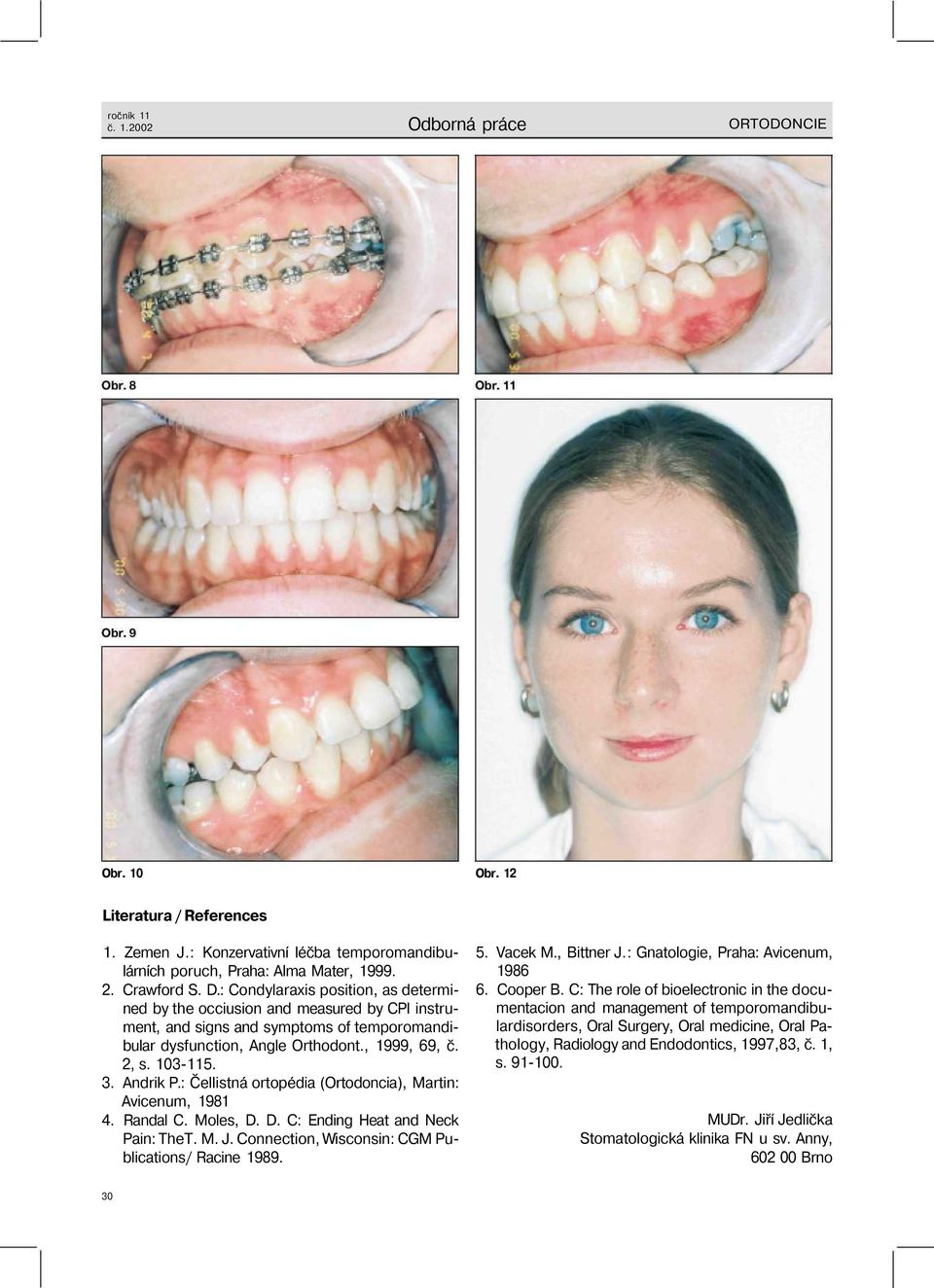 Andrik P.: Čellistná ortopédia (Ortodoncia), Martin: Avicenum, 1981 4. Randal C. Moles, D. D. C: Ending Heat and Neck Pain: TheT. M. J. Connection, Wisconsin: CGM Publications/ Racine 1989. 5.