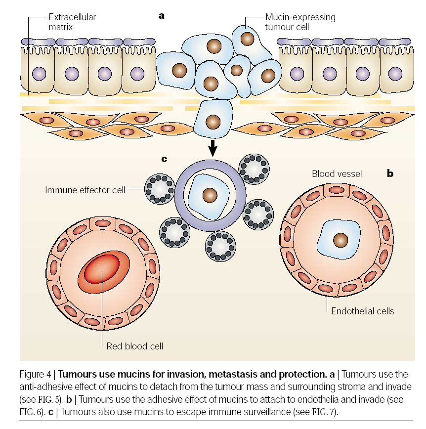 Nádory využívají a) antiadhezívních vlastností mucinů k uvolnění z nádorové masy a okolního stromatu a k invazi,