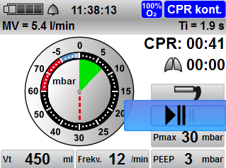 4 Příprava a obsluha V uživatelském menu můžete upravit chování režimu CPR při spuštění: Uživatelské menu Přednastavení pacient Režim CPR. Výsledek Umělé dýchání se provádí v režimu CPR.