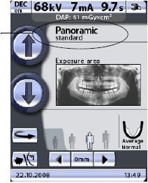 OVLÁDACÍ PANEL 8.2 Výběr panoramatického expozičního programu Přístroj můžete nastavit tak, aby zobrazoval náhled na snímek po expozici. Tím můžete snímek okamžitě po expozici vyhodnotit. Viz kap.