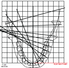 geometrie stejná jako u standardního programu, ale rentgenový paprsek je více kolmý na čelist.