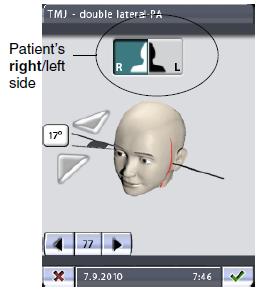 OVLÁDACÍ PANEL Při asymetrickém nastavení dotekem na cílovou oblast na hlavním TMJ displeji, se nastaví pozice snímkování pouze na levé straně pacienta.