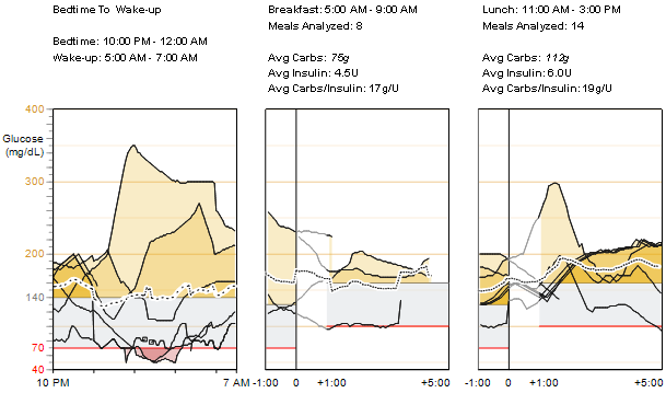 Prehľad hodnôt glukózového senzora čas od uloženia sa k spánku po prebudenie a časy jedál namerané hodnoty a priemery Čas od uloženia sa k spánku po prebudenie Tento graf zobrazuje glukózovú krivku