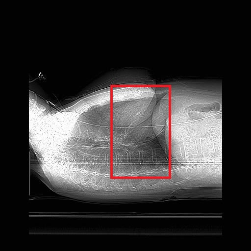 Obrázek 19 Toposcan v sagitální rovině (Autor: MUDr. Korbel) Pro provedení CTKG má radiologický asistent k dispozici dvě alternativy.