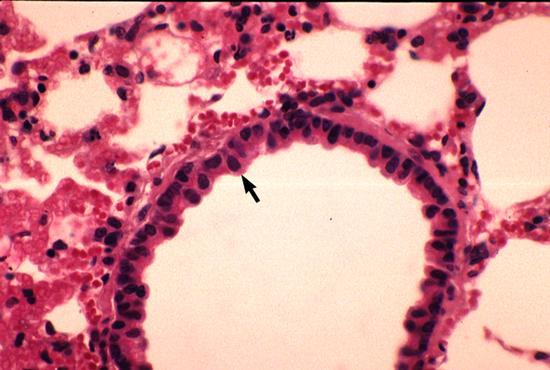 Max Clara 1899 1966 člen NSDAP od 1935 přednosta anatomie v Lipsku pro histologické výzkumy využíval Clara tkáně popravených vězňů Das Nervensystem des Menschen