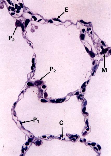 Plicní sklípky Alveoli pulmonis 200 μm velké, polyedrické, tenkostěnné