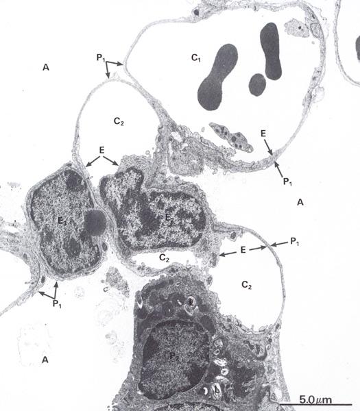 Septum interalveolare Sklípková přepážka buňky fibroblasty (kolagen I. a III.