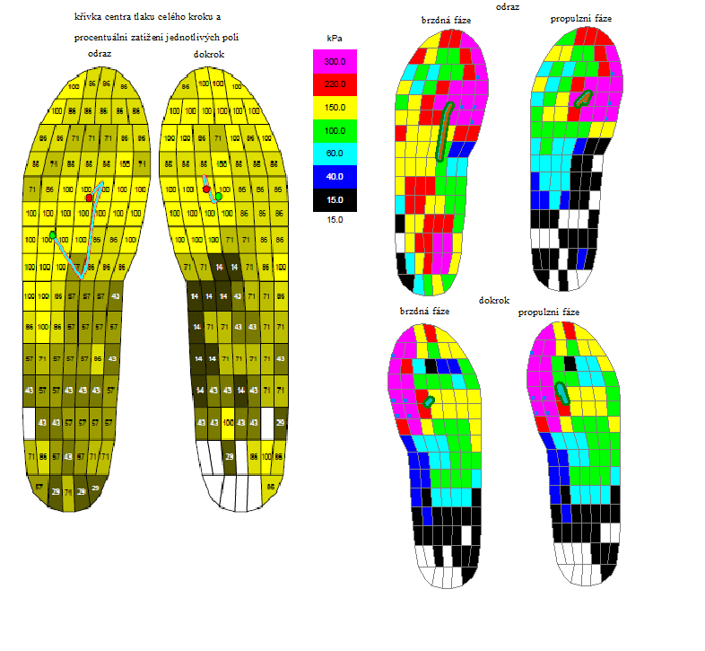 4.2.2 Popis distribuce tlaku a křivky centra tlaku na překážce ze 400 m tratě Obrázek 21 Proband 1-400 m př.
