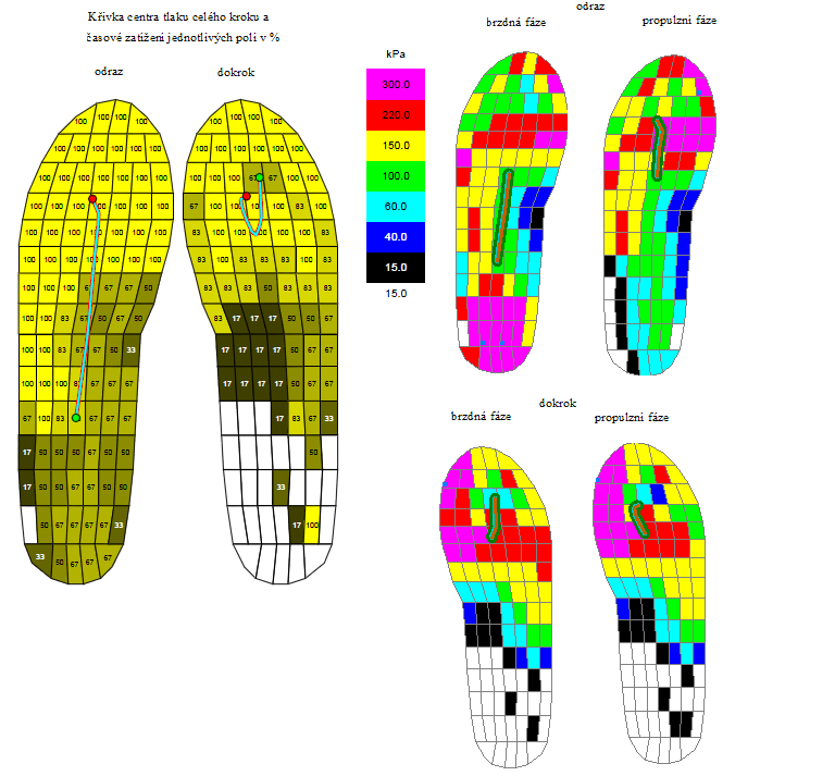 propulzní. Naopak během propulzní fáze se zmenšují hodnoty tlaku na laterální část přednoží a oblast střední nohy zůstává během celého dokroku za překážkou mírně zatížena.