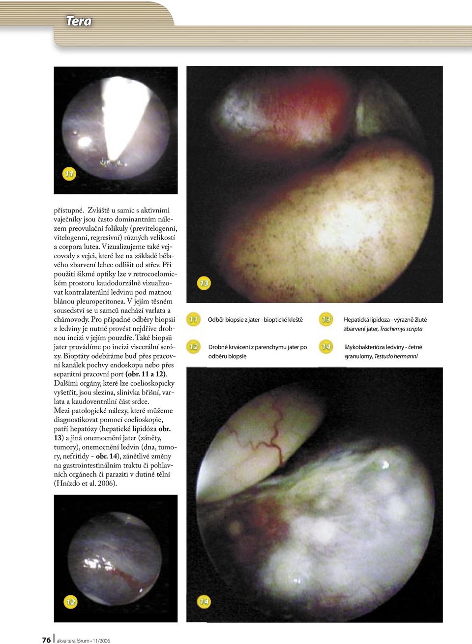 Při použití šikmé optiky lze v retrocoelomickém prostoru kaudodorzálně vizualizovat kontralaterální ledvinu pod matnou blánou pleuroperitonea.