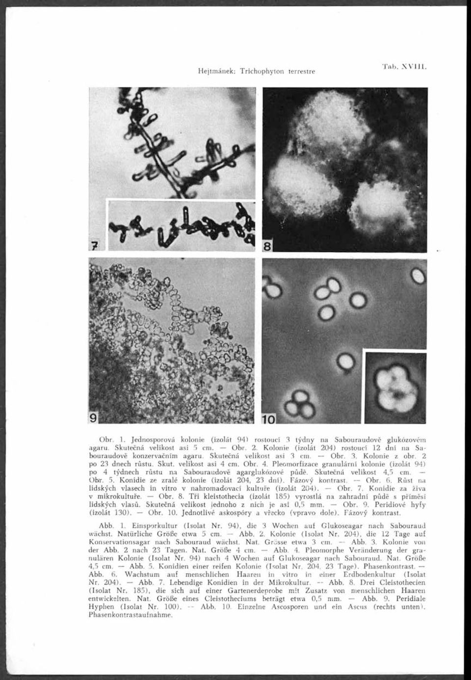 cm. Obr. 4. Pleomorfizace granulární kolonie (izolát 94) po 4 týdnech růstu na Sabouraudově agarglukózové půdě. Skutečná velikost 4,5 cm. Obr. 5. Konidie ze zralé kolonie (izolát 204, 23 dní).