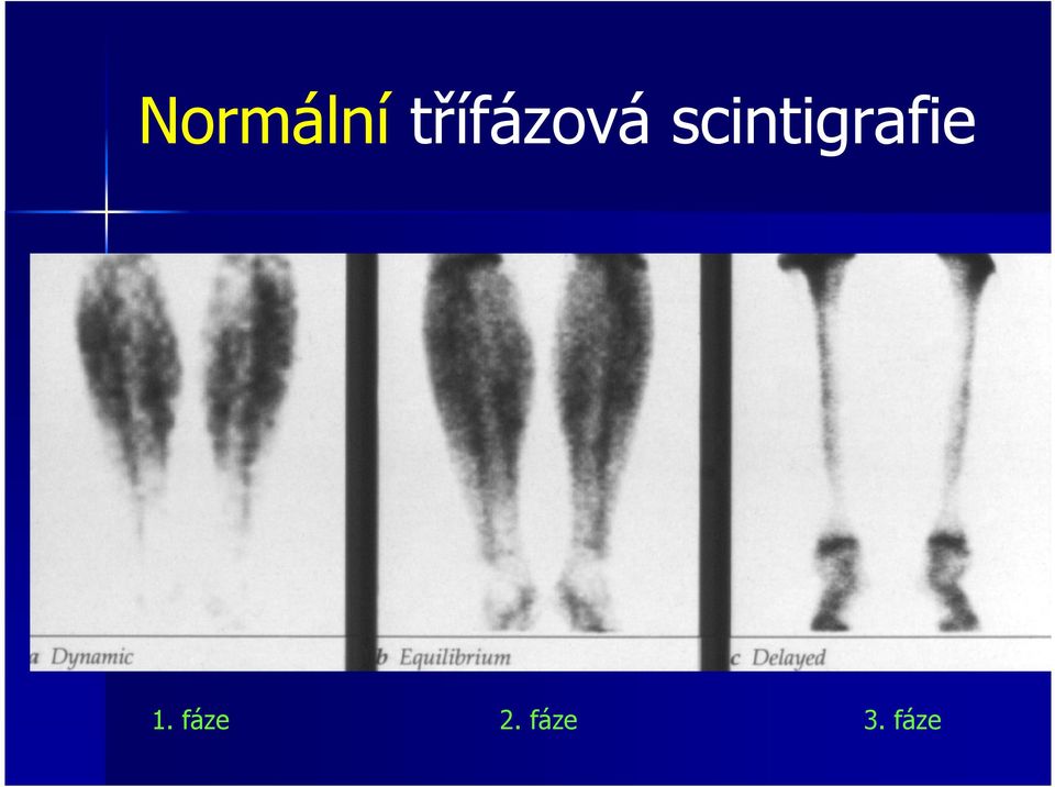 scintigrafie