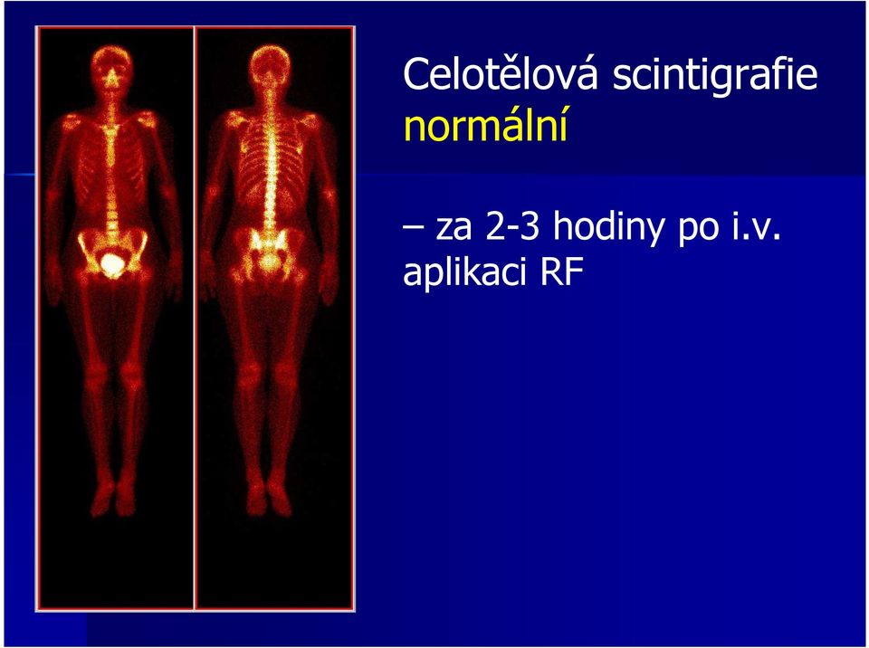 normální za 2-3