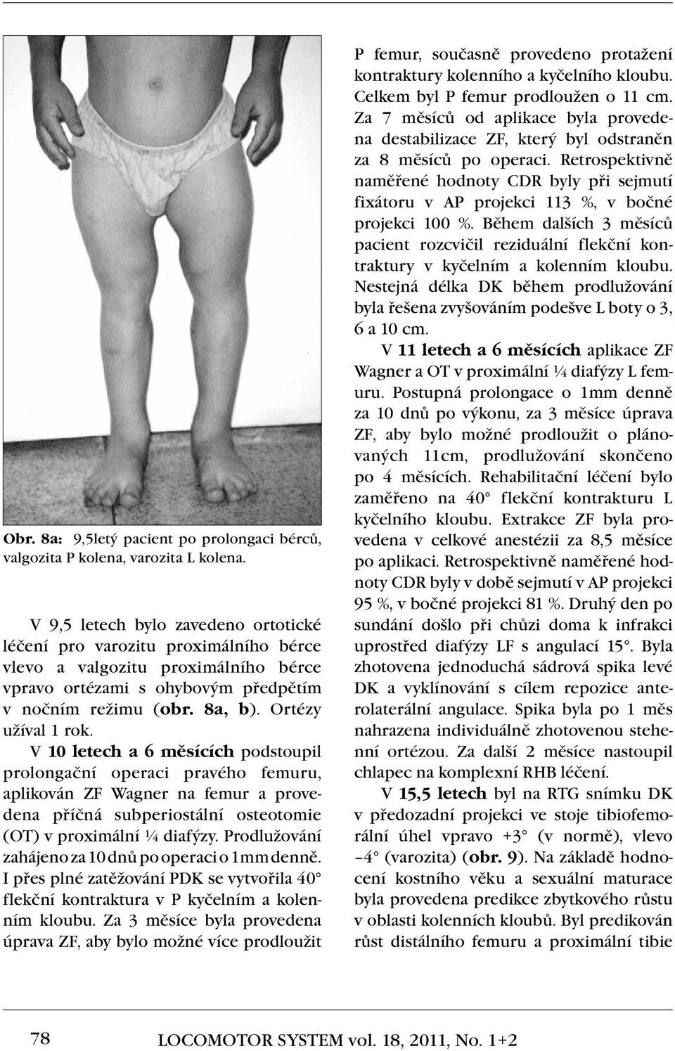 V 10 letech a 6 měsících podstoupil prolongační operaci pravého femuru, aplikován ZF Wagner na femur a provedena příčná subperiostální osteotomie (OT) v proximální ¼ diafýzy.