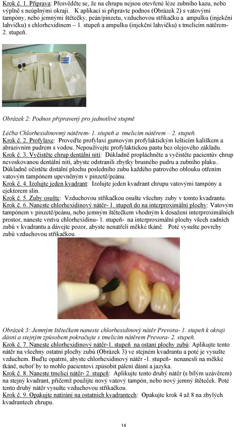 stupeň a ampulku (injekční lahvičku) s tmelicím nátěrem- 2. stupeň. Obrázek 2: Podnos připravený pro jednotlivé stupně Léčba Chlorhexidinovmý nátěrem- 1. stupeň a tmelicím nátěrem 2. stupeň. Krok č.