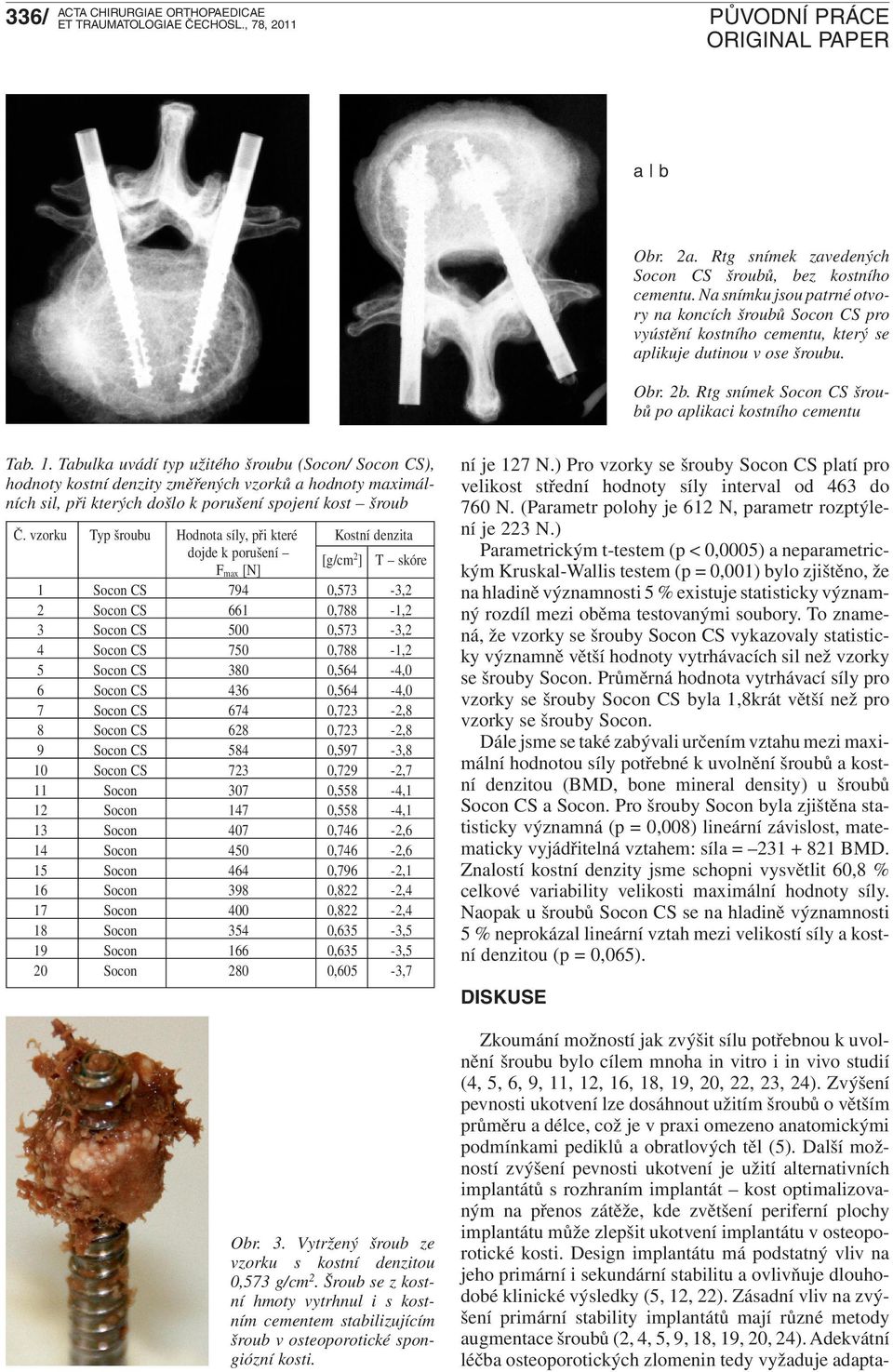 Tabulka uvádí typ užitého šroubu (Socon/ Socon CS), hodnoty kostní denzity změřených vzorků a hodnoty maximálních sil, při kterých došlo k porušení spojení kost šroub Č.