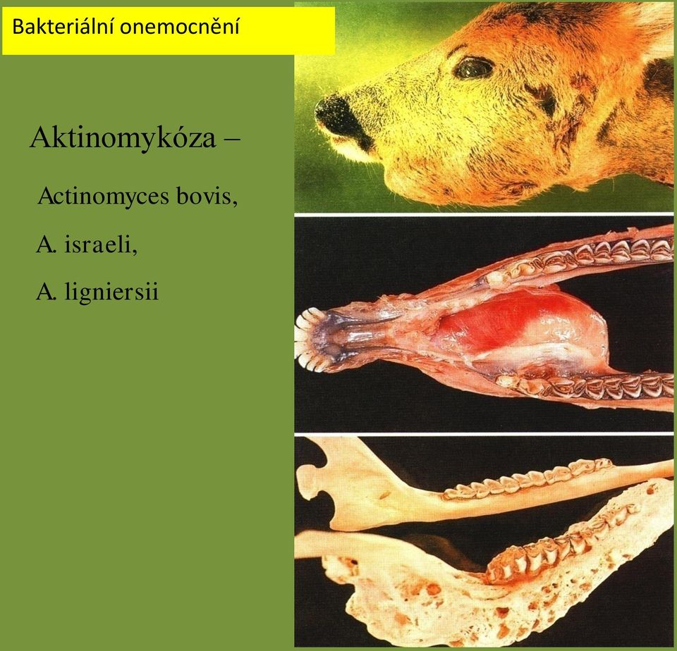 Aktinomykóza