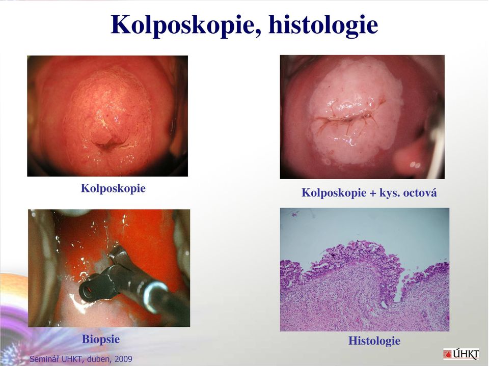 Kolposkopie