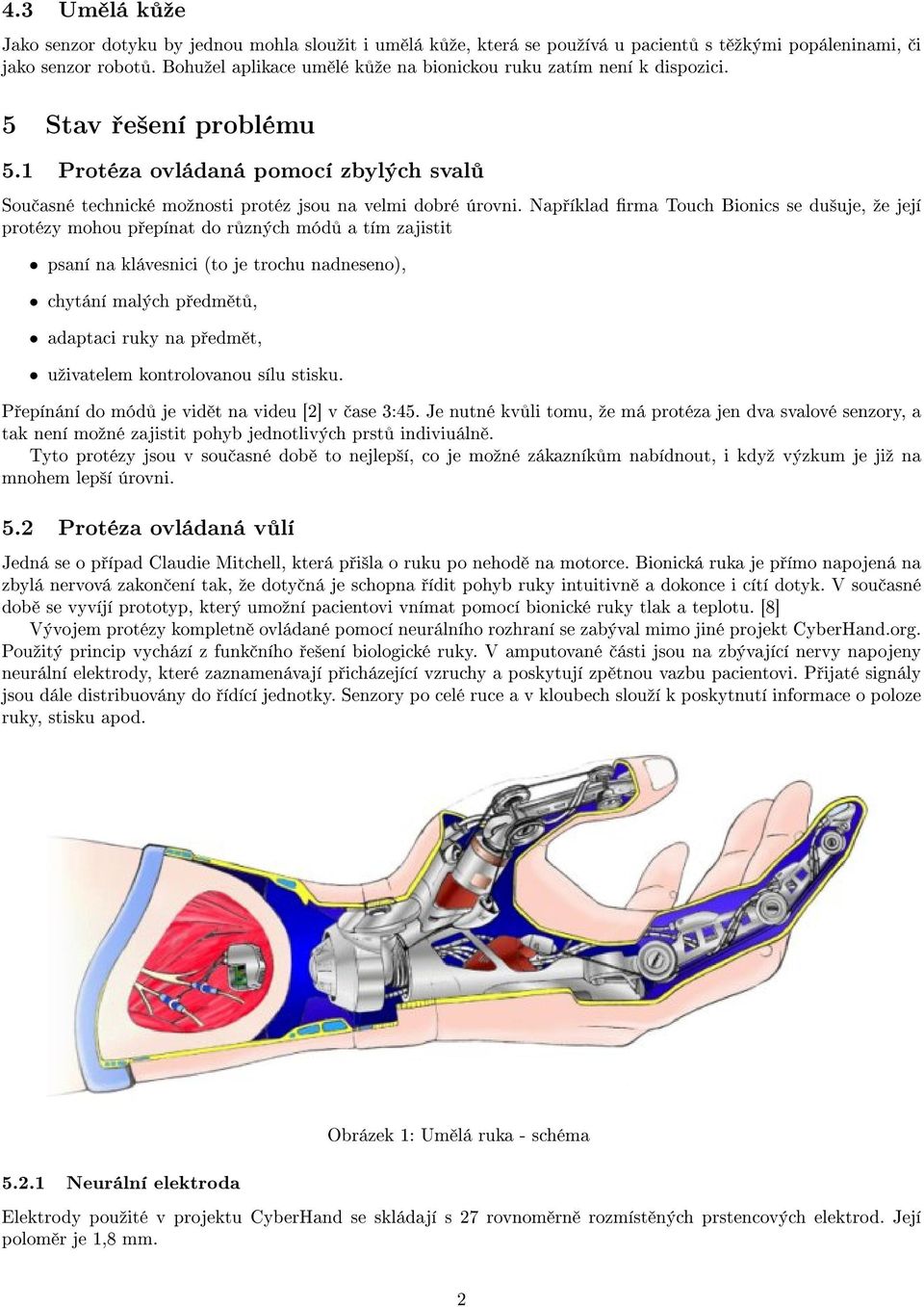 Nap íklad rma Touch Bionics se du²uje, ºe její protézy mohou p epínat do r zných mód a tím zajistit psaní na klávesnici (to je trochu nadneseno), chytání malých p edm t, adaptaci ruky na p edm t,