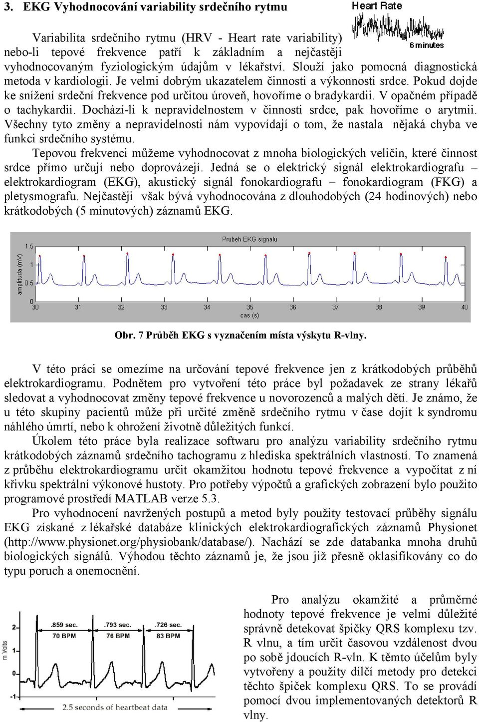 Pokud dojde ke snížení srdeční frekvence pod určitou úroveň, hovoříme o bradykardii. V opačném případě o tachykardii. Dochází-li k nepravidelnostem v činnosti srdce, pak hovoříme o arytmii.