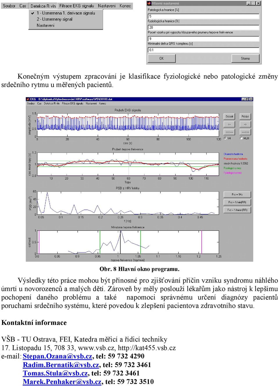 Zároveň by měly poslouží lékařům jako nástroj k lepšímu pochopení daného problému a také napomoci správnému určení diagnózy pacientů poruchami srdečního systému, které povedou k zlepšení