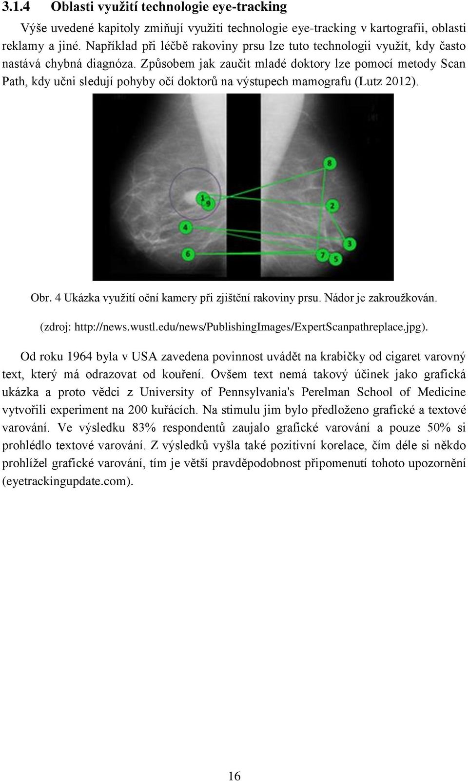 Způsobem jak zaučit mladé doktory lze pomocí metody Scan Path, kdy učni sledují pohyby očí doktorů na výstupech mamografu (Lutz 2012). Obr. 4 Ukázka využití oční kamery při zjištění rakoviny prsu.