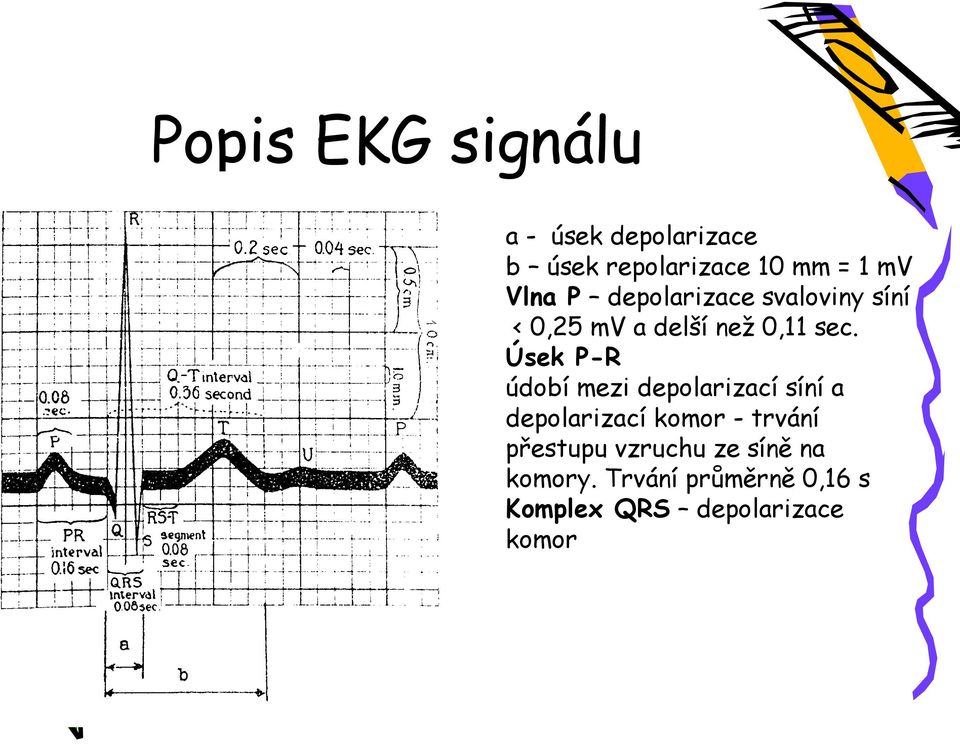 Úsek P-R údobí mezi depolarizací síní a depolarizací komor - trvání