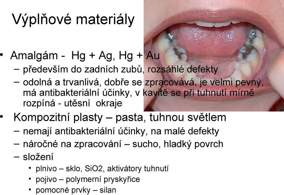 okraje Kompozitní plasty pasta, tuhnou světlem nemají antibakteriální účinky, na malé defekty náročné na