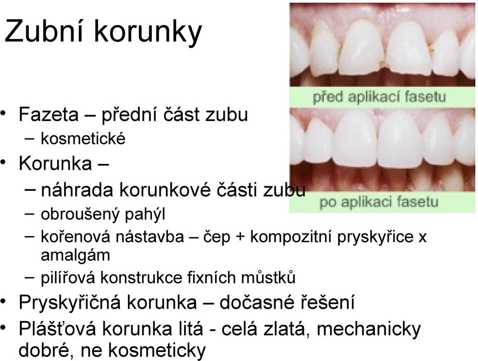 pryskyřice x amalgám pilířová konstrukce fixních můstků Pryskyřičná