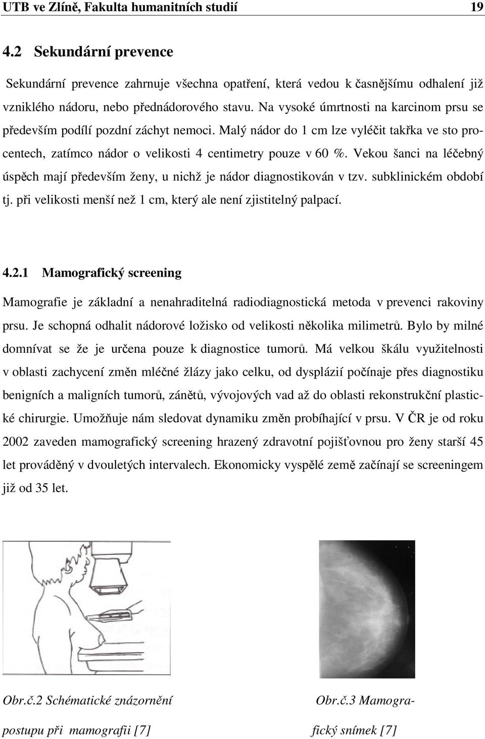 Vekou šanci na léčebný úspěch mají především ženy, u nichž je nádor diagnostikován v tzv. subklinickém období tj. při velikosti menší než 1 cm, který ale není zjistitelný palpací. 4.2.