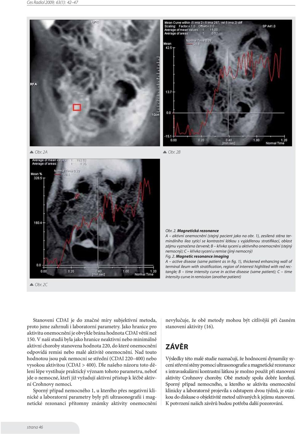 remise (jiný nemocný) Fig. 2. Magnetic resonance imaging A active disease (same patient as in fig.