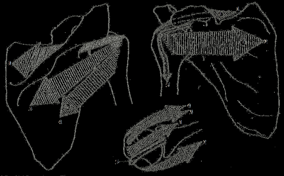 1.2.2.2 Aktivní komponenty ramenního kloubu Jsou svaly ramenního kloubu a paže m. pectoralis major, m. latissimus dorsi, m. deltoideus, m. teres major, m. teres minor, m. supraspinatus, m.