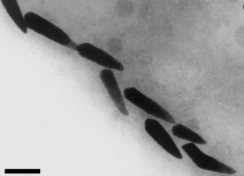 Cesty ke zvýšení SHP Použití magnetosomů magnetických nanočástic Fe