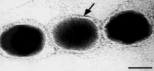 bakteriemi = ideálně monodisperzní systém neinteragujících částic 30