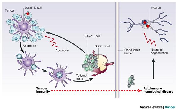 Paraneoplastické neurologické