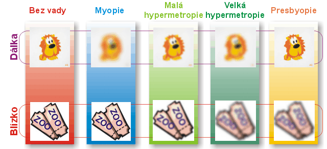 přídavek do blízka. Jestliže se vrcholová lámavost brýlí do dálky shoduje s přídavkem na blízko, potom nepotřebuje do blízka nic.