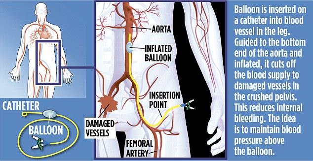 Intraoperační techniky Použití resuscitačního okluzního endovaskulárního