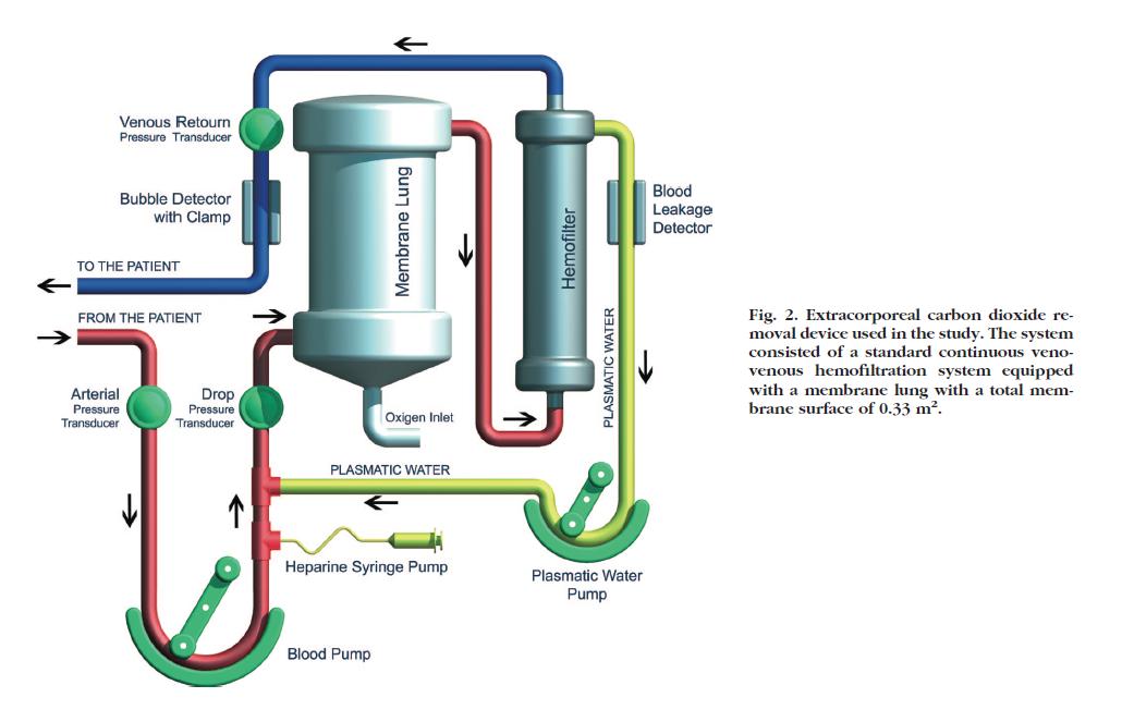 EXTRACORPOREAL DECAP SYSTEMS AND