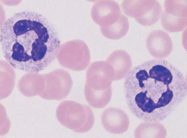 Neutrofilní granulocyty - Barví se kyselými a zásaditými barvivy - Segmentované