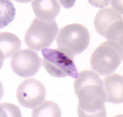 LABORATORNÍ DIAGNOSTIKA MALÁRIE URČENÍ DRUHU PLASMODIA Plasmodium