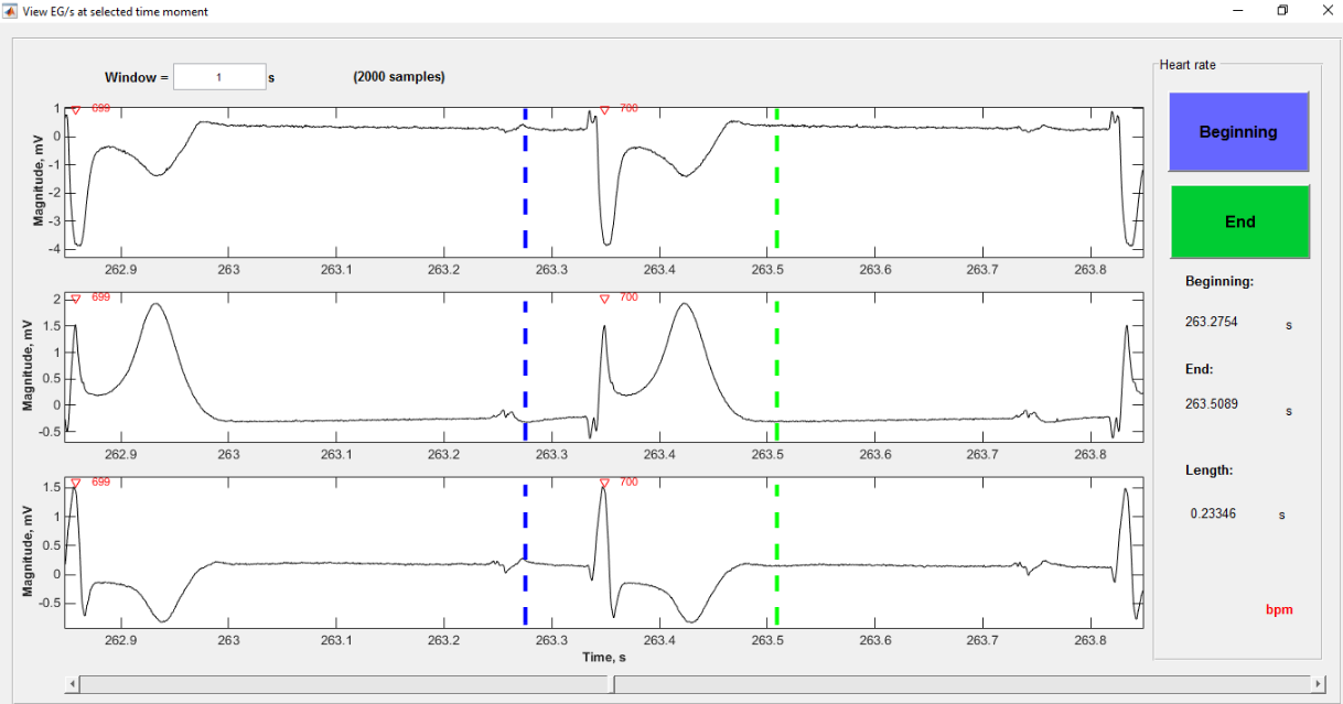 3.2. Rozbor předchozího programu EG RR View Program EG_RR_View slouží pouze k náhledu na RR intervaly EKG.