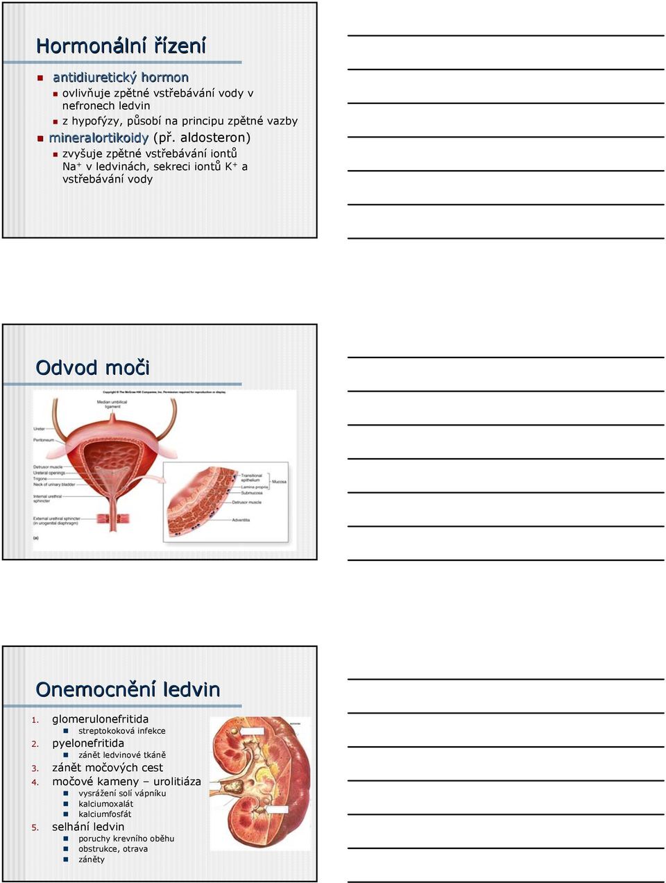 aldosteron) zvyšuje zpětné vstřebávání iontů Na + v ledvinách, sekreci iontů K + a vstřebávání vody Odvod moči Onemocnění ledvin 1.