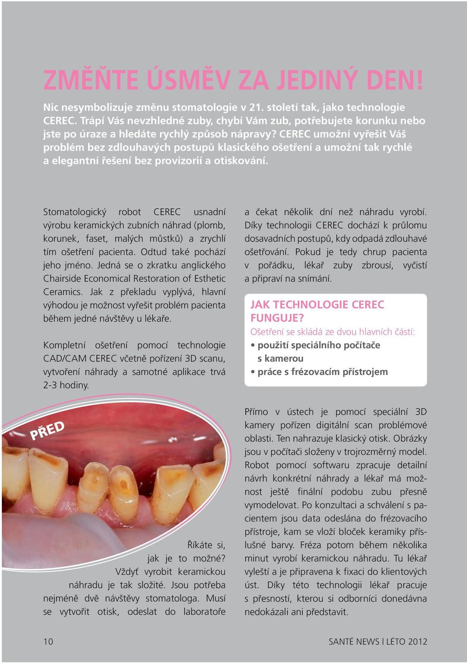 CEREC umožní vyřešit Váš problém bez zdlouhavých postupů klasického ošetření a umožní tak rychlé a elegantní řešení bez provizorií a otiskování.