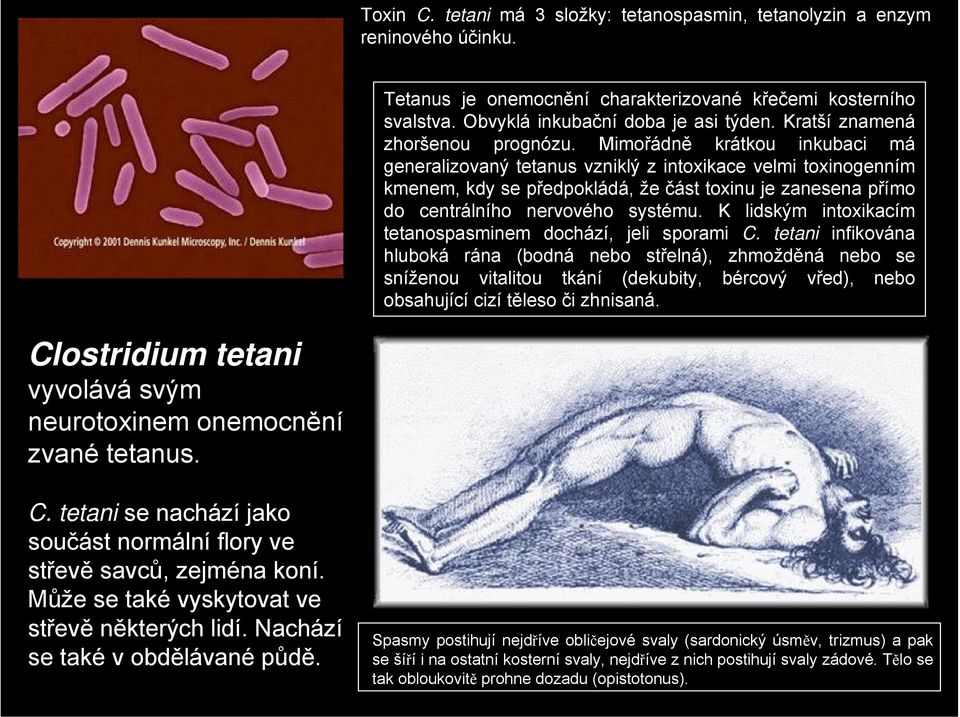 Mimořádně krátkou inkubaci má generalizovaný tetanus vzniklý z intoxikace velmi toxinogenním kmenem, kdy se předpokládá, že část toxinu je zanesena přímo do centrálního nervového systému.