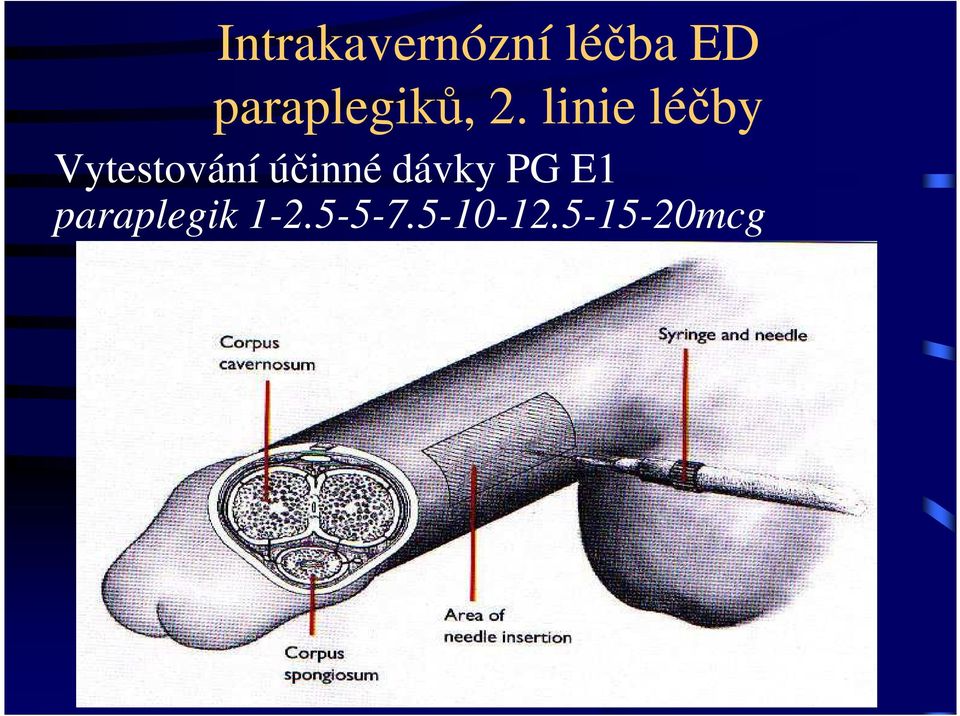 linie léčby Vytestování účinné