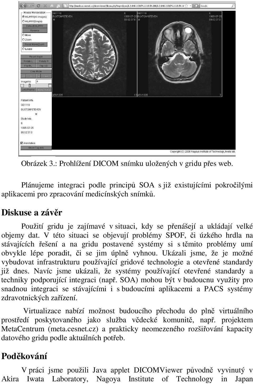 V této situaci se objevují problémy SPOF, či úzkého hrdla na stávajících řešení a na gridu postavené systémy si s těmito problémy umí obvykle lépe poradit, či se jim úplně vyhnou.